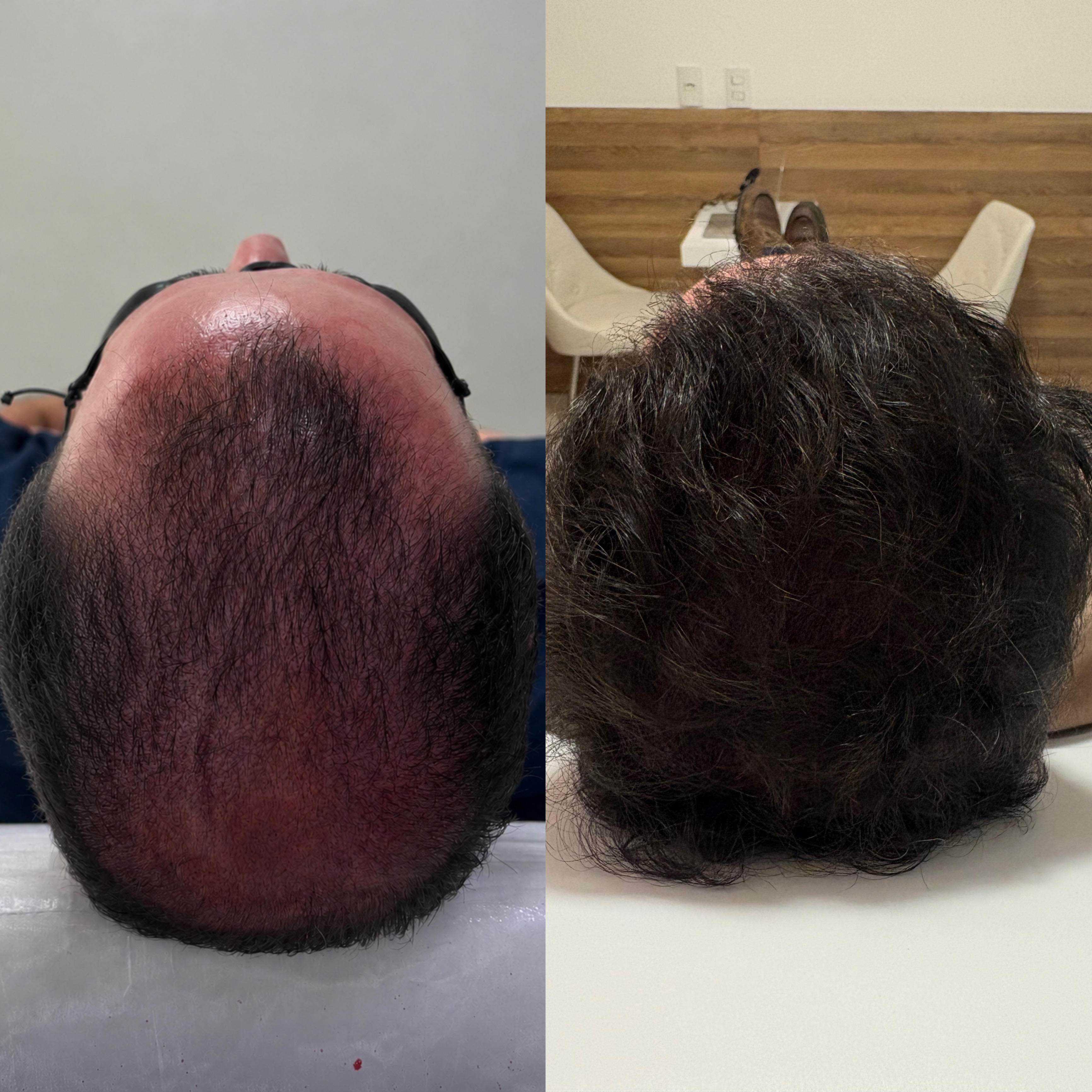 Caso de Resultado 2